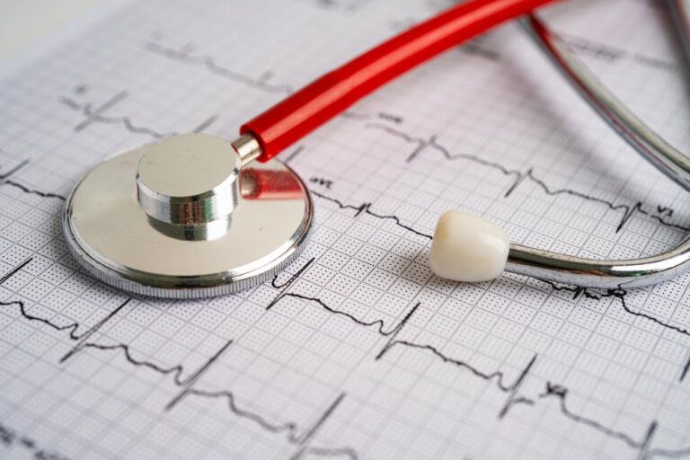 stetoscopio sull elettrocardiogramma rapporto sul cardiogramma di attacco cardiaco a onde cardiache ecg